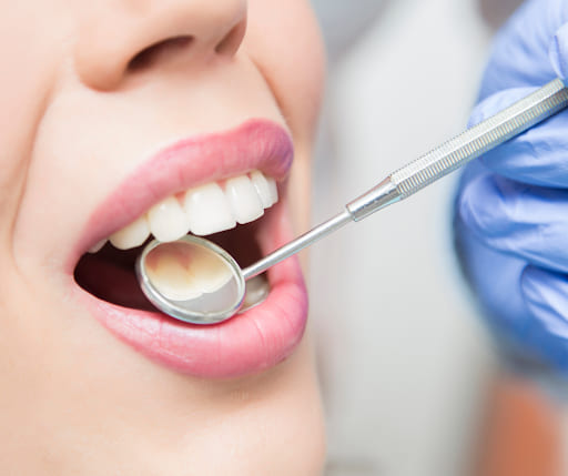 caries