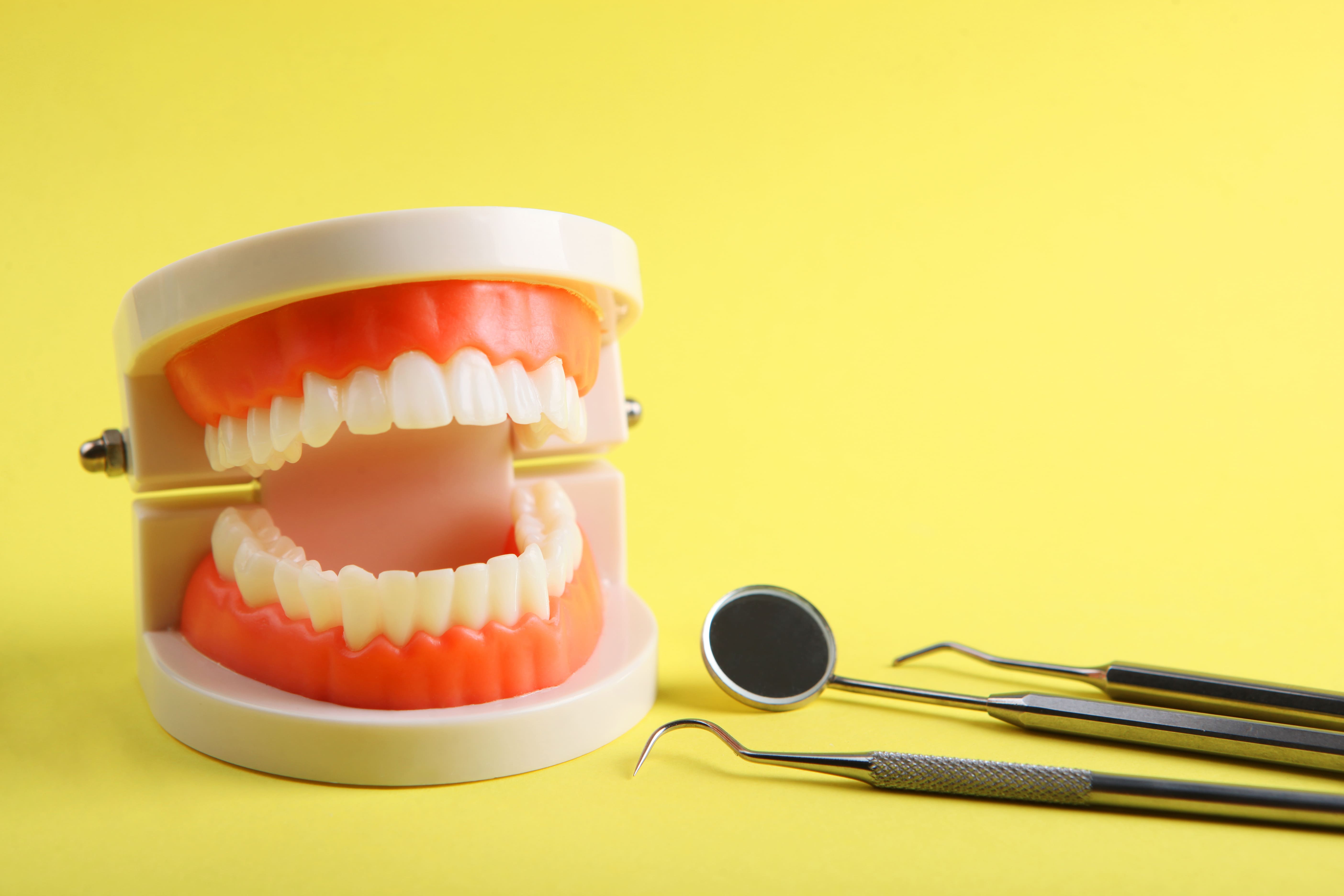 caries