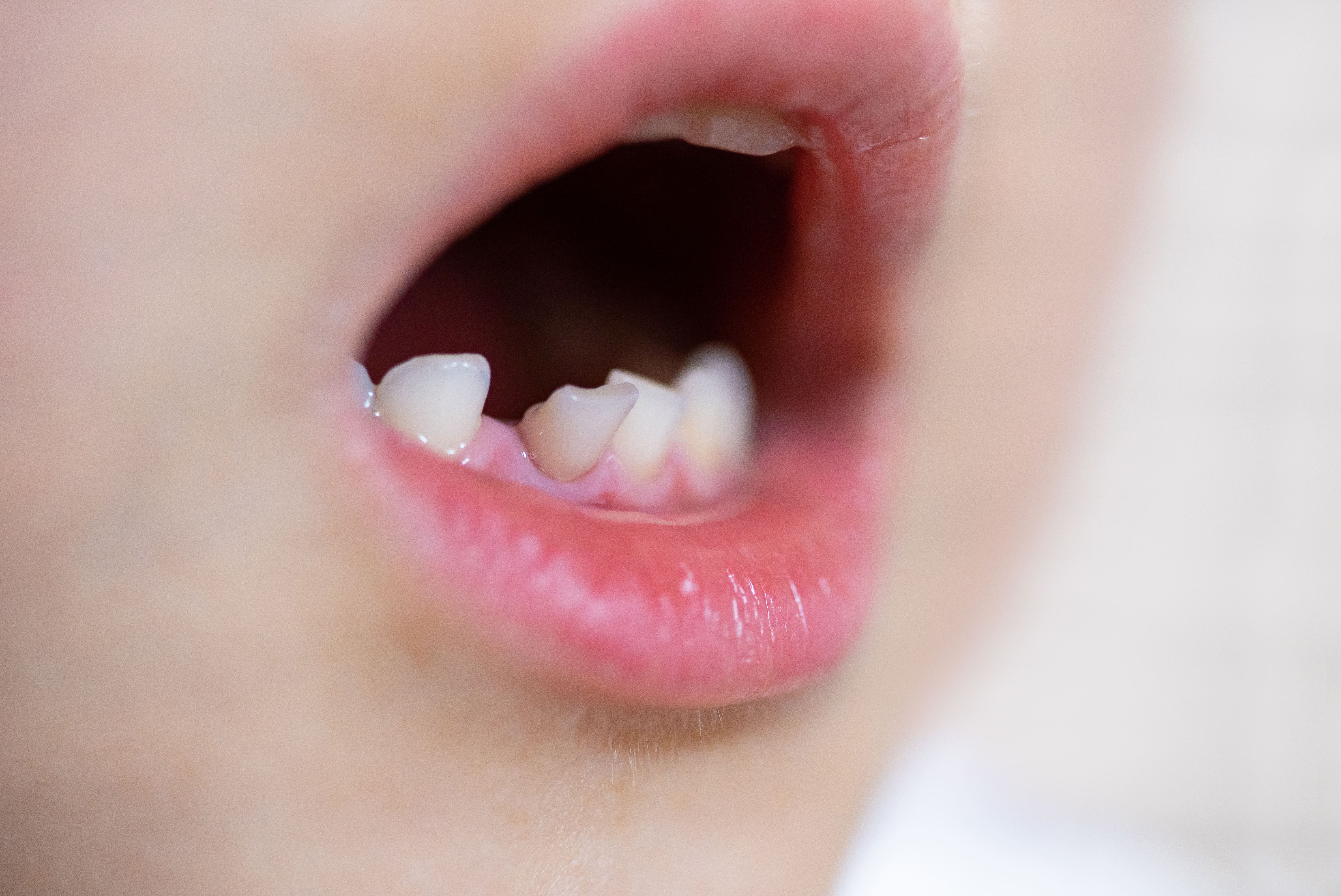 child-ortho
