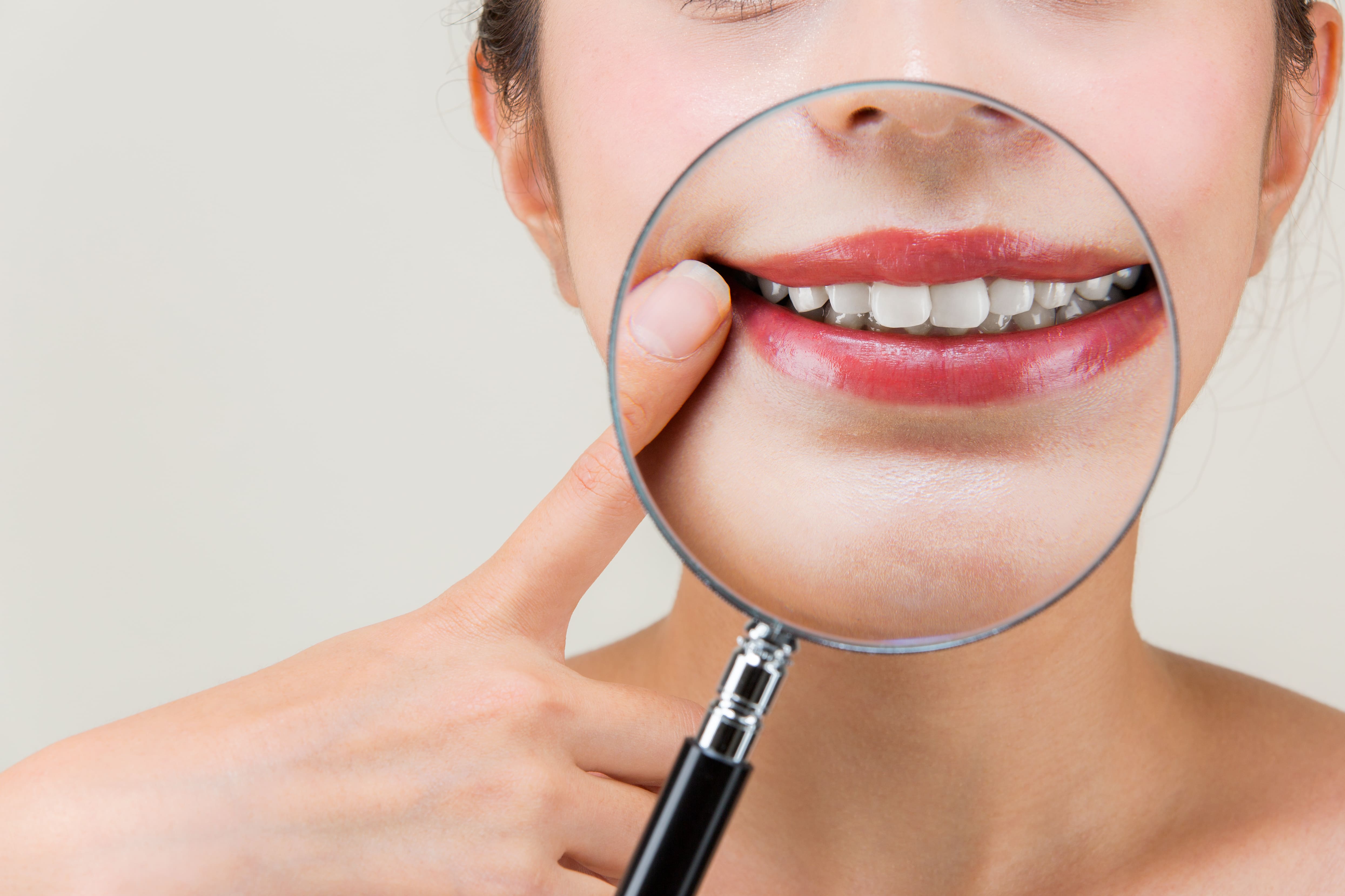 whitening